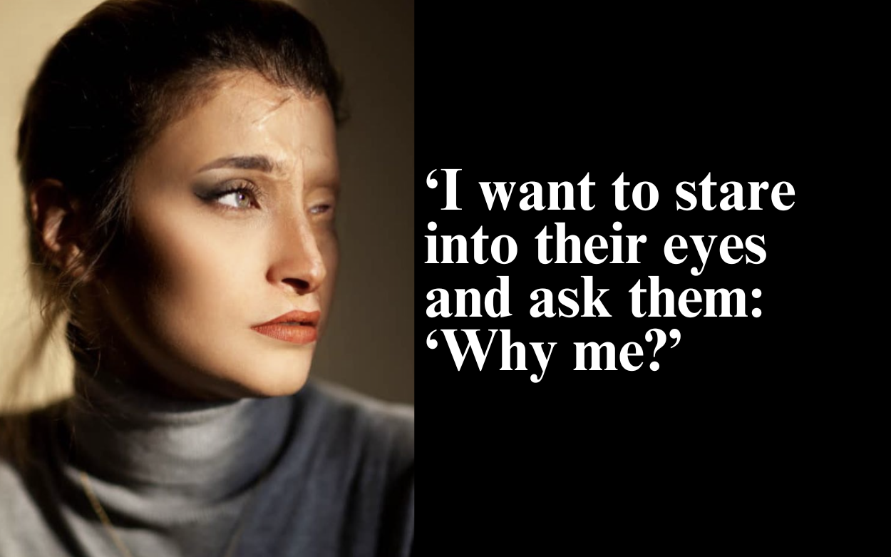 SHE WENT TO THE DENTIST – THEY ERASED HER FACE