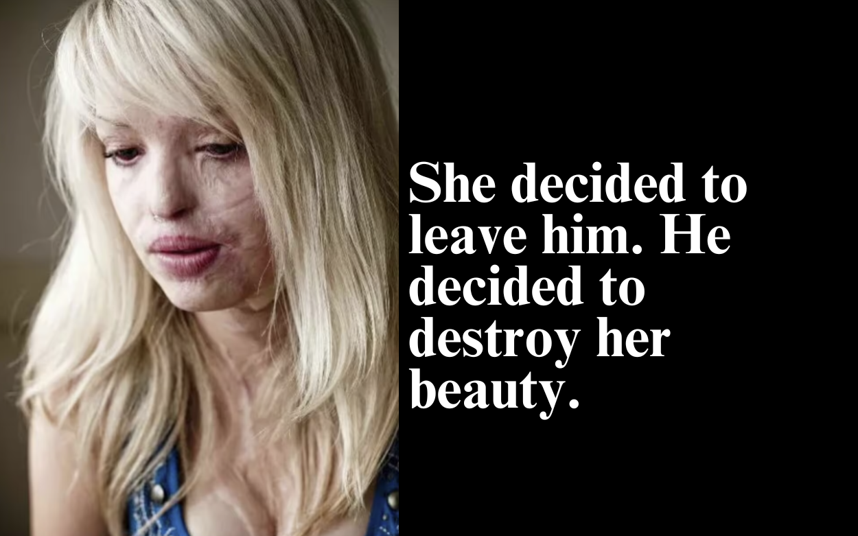 ‘I COULD LET THEM WIN OR HAVE AN AMAZING LIFE’