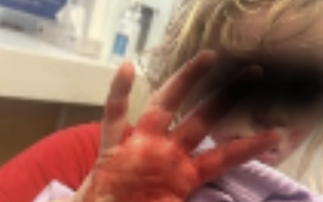 a nine-year-old girl is lucky to have not been killed or permanently disfigured after a 16-year-old boy beat her severely in Ballarat.